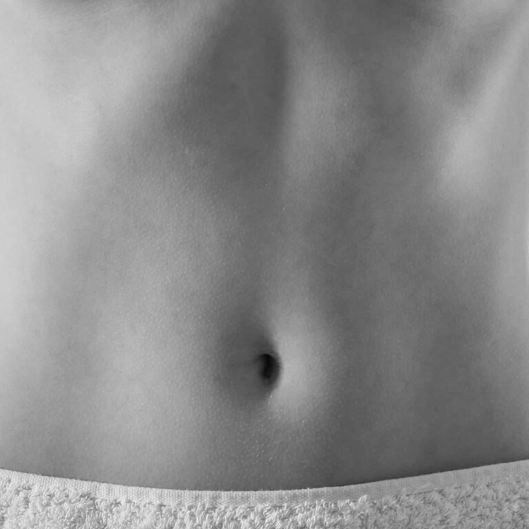 Bauch­deckenplastik Bauchdecken­straffung