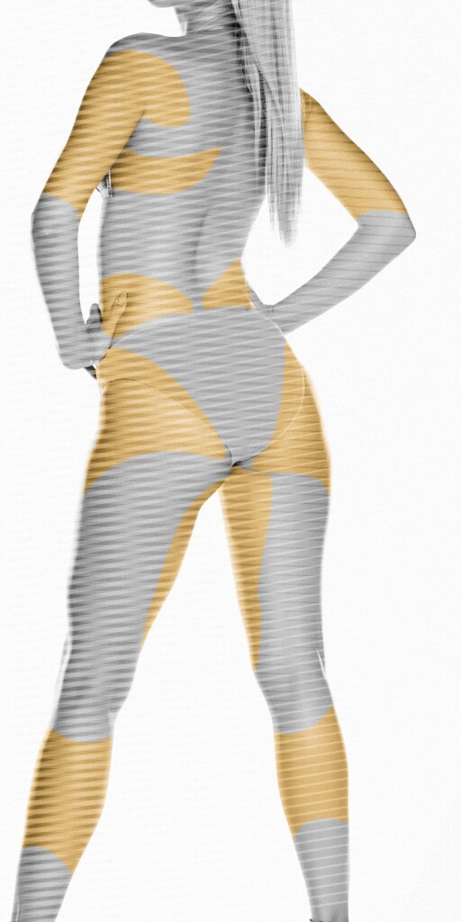 Fettab­saugung (Lipo­suktion)